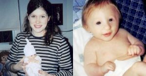 «It turns out that Thumbelina is real!» Here’s how a girl with a rare disease lives 17 years later